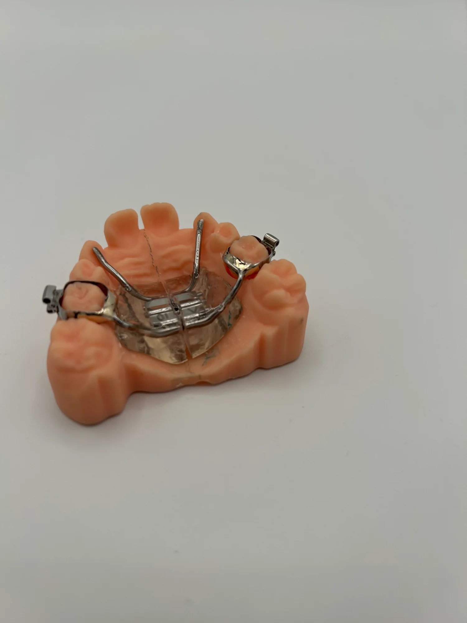 Manufaktura Ortodoncji - Praca 3